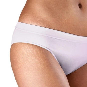 Maquillage permanent corps