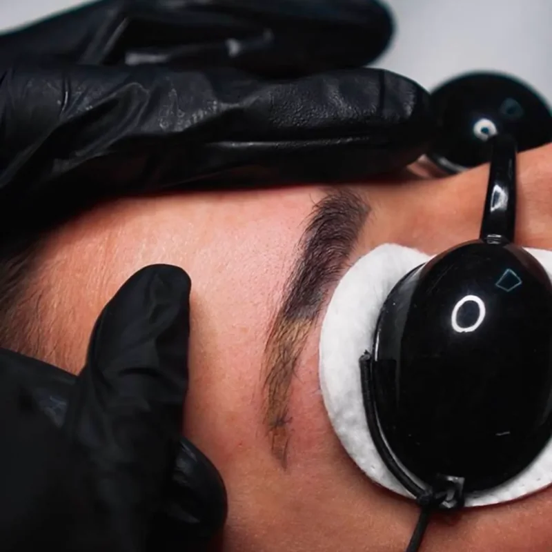 Maquillage permanent depigmentation