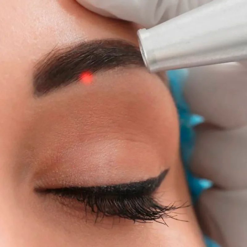 Maquillage permanent depigmentation