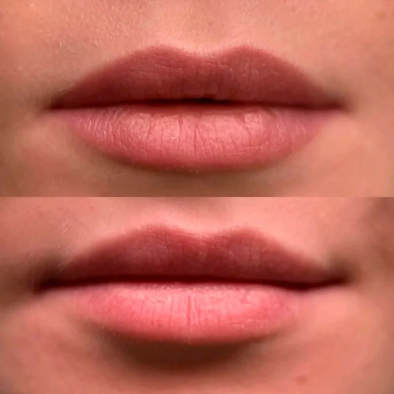 Maquillage permanent levres